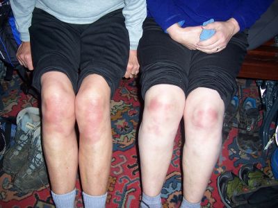 Whose Knees are these?